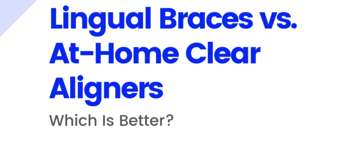 Lingual Braces vs At-Home Clear Aligners
