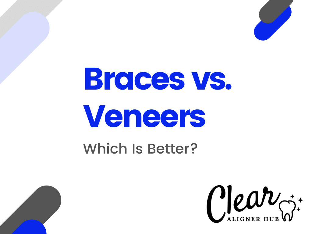 Braces vs Veneers