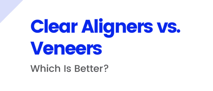 Clear Aligners vs. Veneers